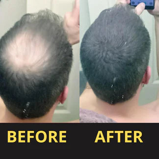 Life changing